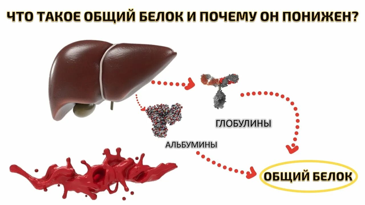 Причина низкого общего белка в крови. Общий белок. Общий белок в крови понижен. Общий белок понижен причины. Снижен общий белок в крови.