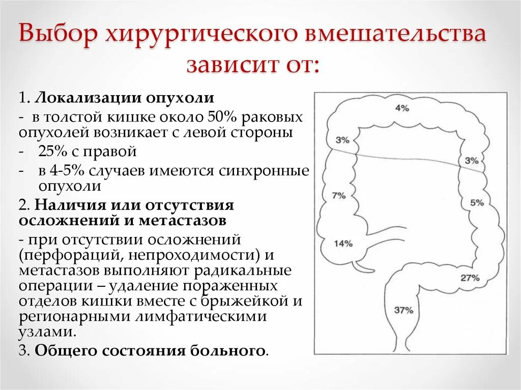 Локализации опухолей кишечник. Опухоль ободочной кишки. Опухоль толстой кишки локализации. Схема операций на толстом кишечнике. Рак кишечника операция прогноз