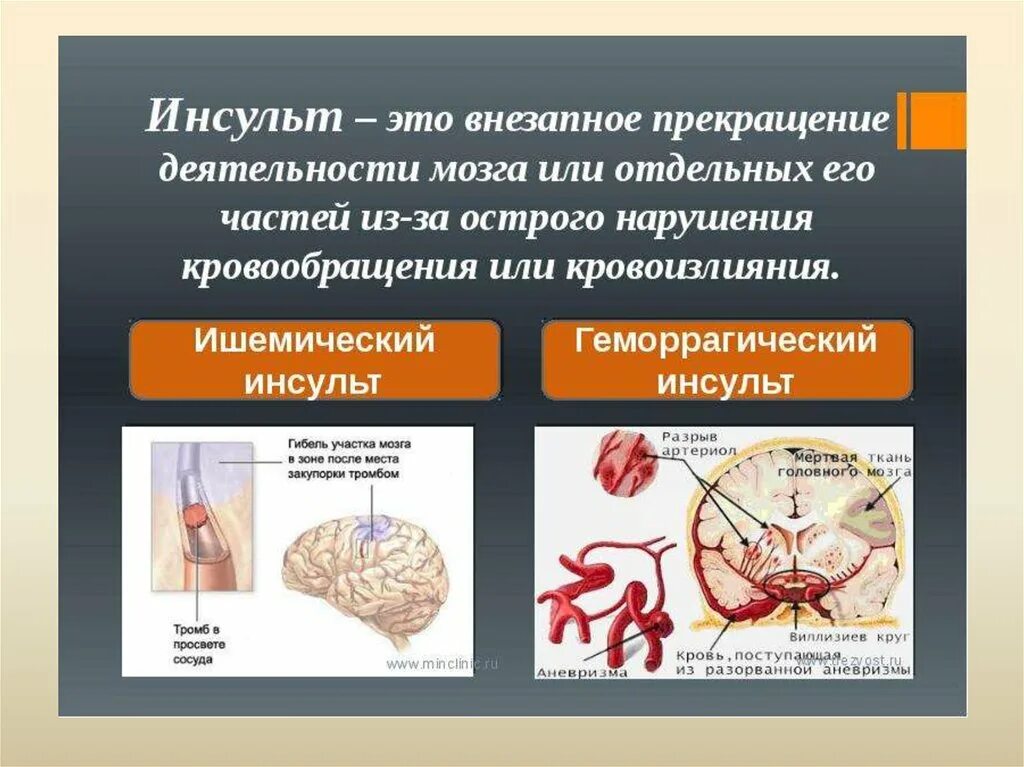 Нарушение кровообращения первая помощь. Презентация на тему инсульт. Ишемический инсульт презентация. Презентация на тему геморрагический инсульт.