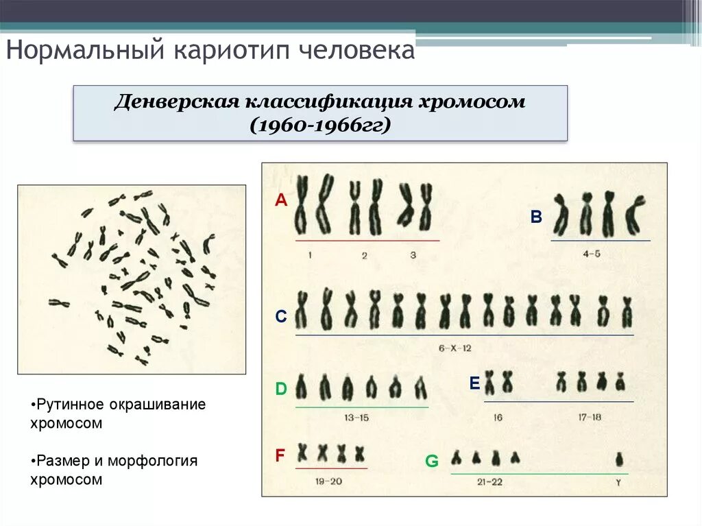 Кариотип классификация хромосом. Кариотип человека Денверская классификация хромосом. Кариотип человека классификация хромосом человека. Клетка печени кариотип.