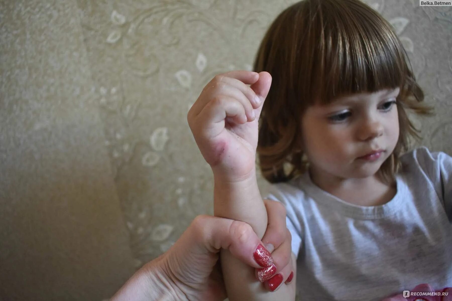 Фото девушек пальчик. Пальчиком девочки маленькой. Обсосанный палец ребенка. Вредная привычка сосание пальца у детей.