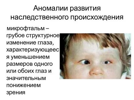Пороки развития
