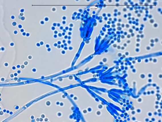 Пеницилл под микроскопом. Пеницилум микробиология. penicillium микробиология 40 x. пенициллиум препарат микробиология. пенициллин препарат микробиология.
