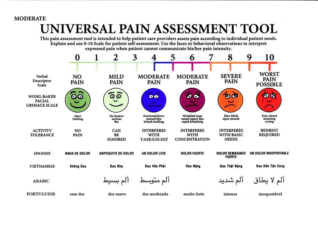 Open scale. Pain assessment scale. самые сильные боли по шкале. улучшенная таблица боли. универсальная диаграмма уровня боли.