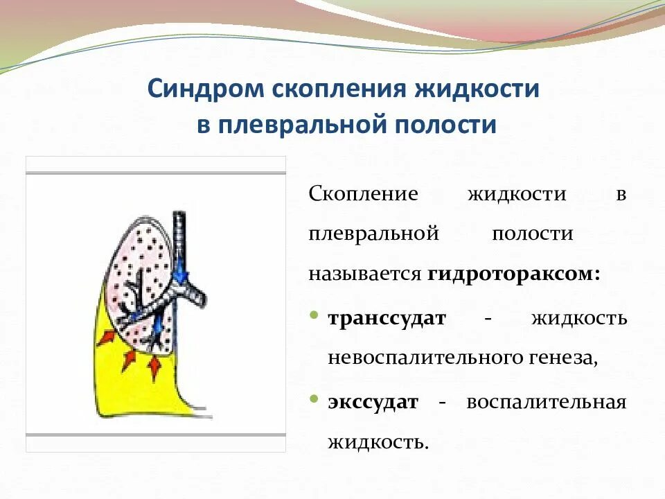 Скопление в плевральной полости