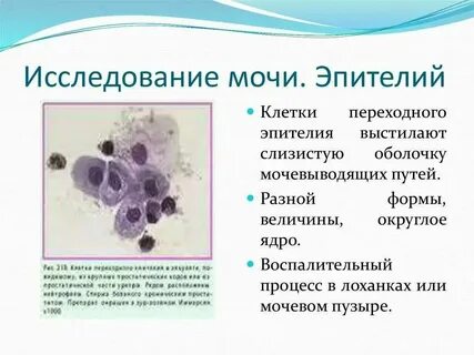 Эпителиальные клетки в мазке много что значит