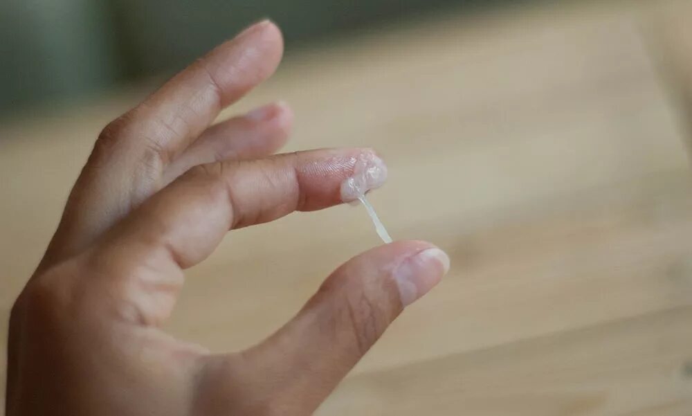 нормальные влагалищные выделения. белые творожистые выделения при молочнице. бели у женщин лечение. бели у женщин лечение. прозрачные водянистые выделения.