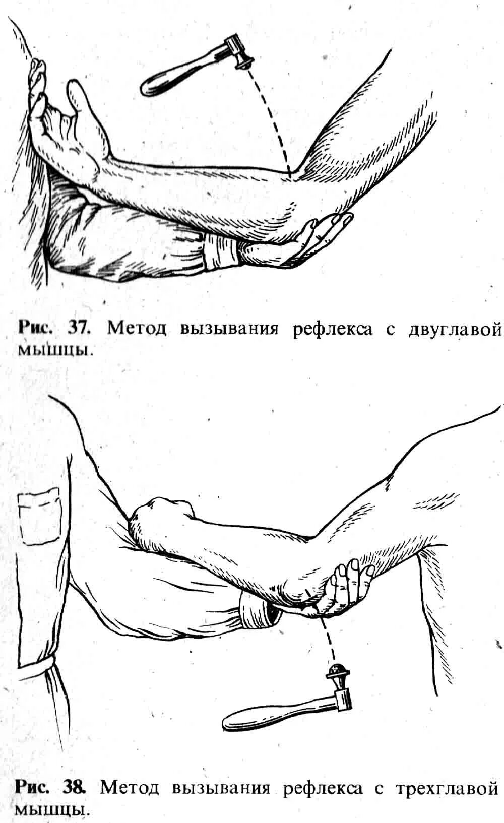 Запястно лучевой рефлекс. Исследование пястно лучевой рефлекс. Карпорадиальный локтевой рефлекс. Карпорадиальный (запястно-лучевой) рефлекс.