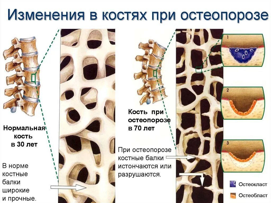 Содержимое в костях