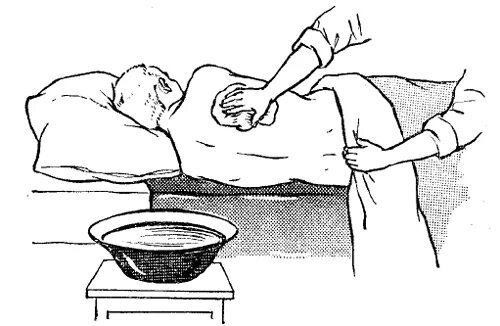 Кожу тяжелобольного пациента протирают. Личная гигиена тяжелобольного пациента профилактика пролежней. Обтирание больного частичная санитарная обработка больного. Обработка кожи тяжелобольного пациента. Мытье туловища тяжелобольного пациента.