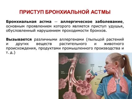 Бронхи при приступе бронхиальной астмы