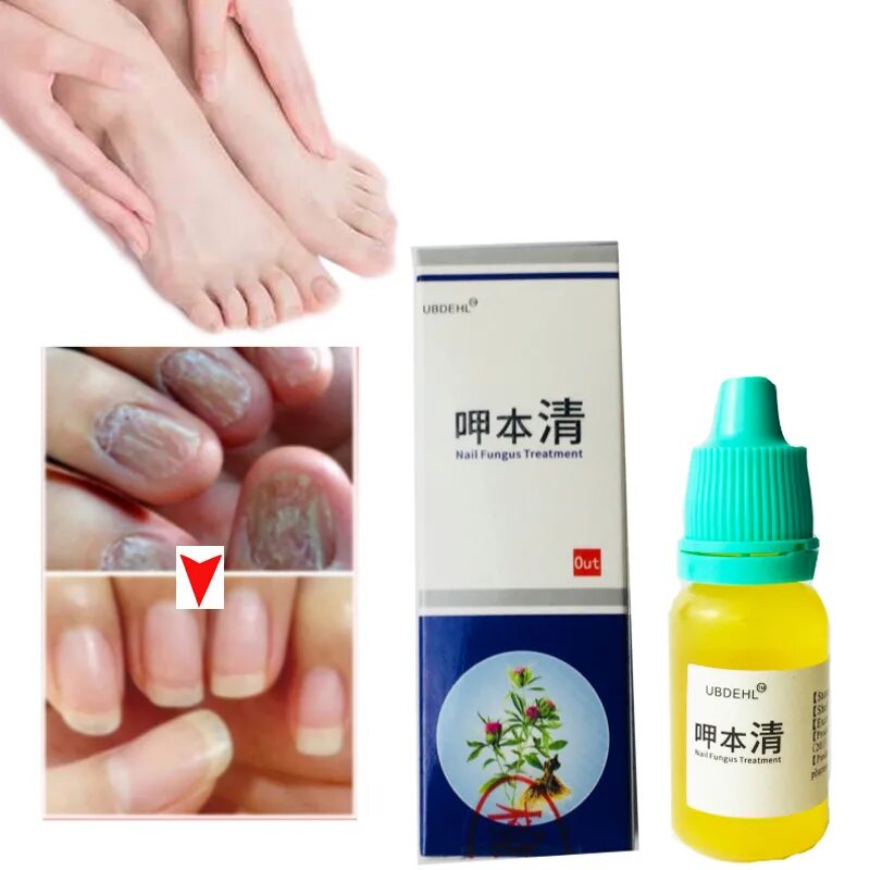 паронихия лечение мазь