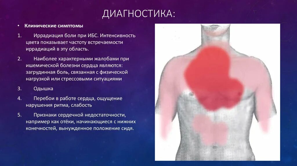 Боли при ишемии