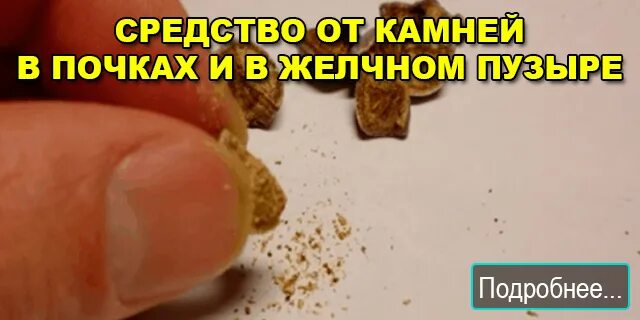Народные средства мочекаменной болезни. Отвар из пшена. Как народными средствами удалить камни. Препараты для растворения камней в желчном пузыре. Препараты для выведения камней из почек.