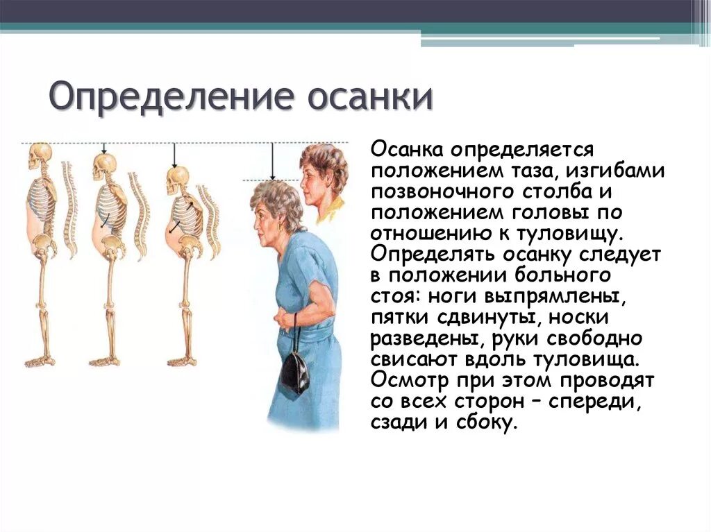 Осанку определяют как