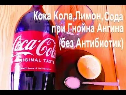 Сода при гнойной ангине