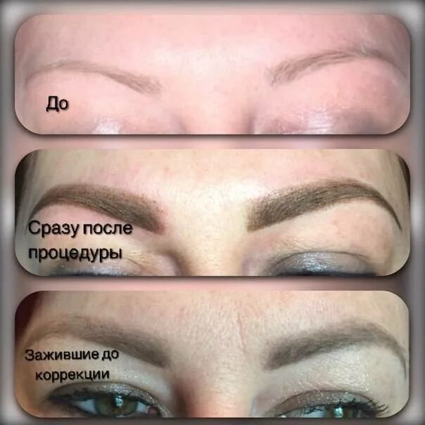 Почему не проявился пигмент после татуажа: возможные причины и решения