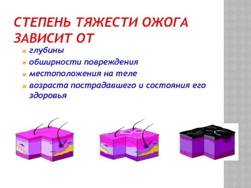 Установите соответствие степени ожога. Классификация ожогов по степени тяжести. Ожоги по степени тяжести первая помощь. Степень тяжести ожога зависит от.