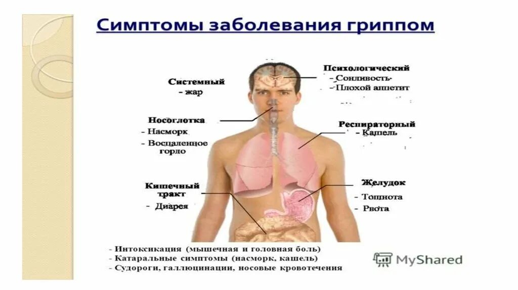 Грипп симптомы 2024 лечение. Грипп испанка симптомы. Симптомы гриппа. Испанский грипп симптомы. Признаки гриппа.