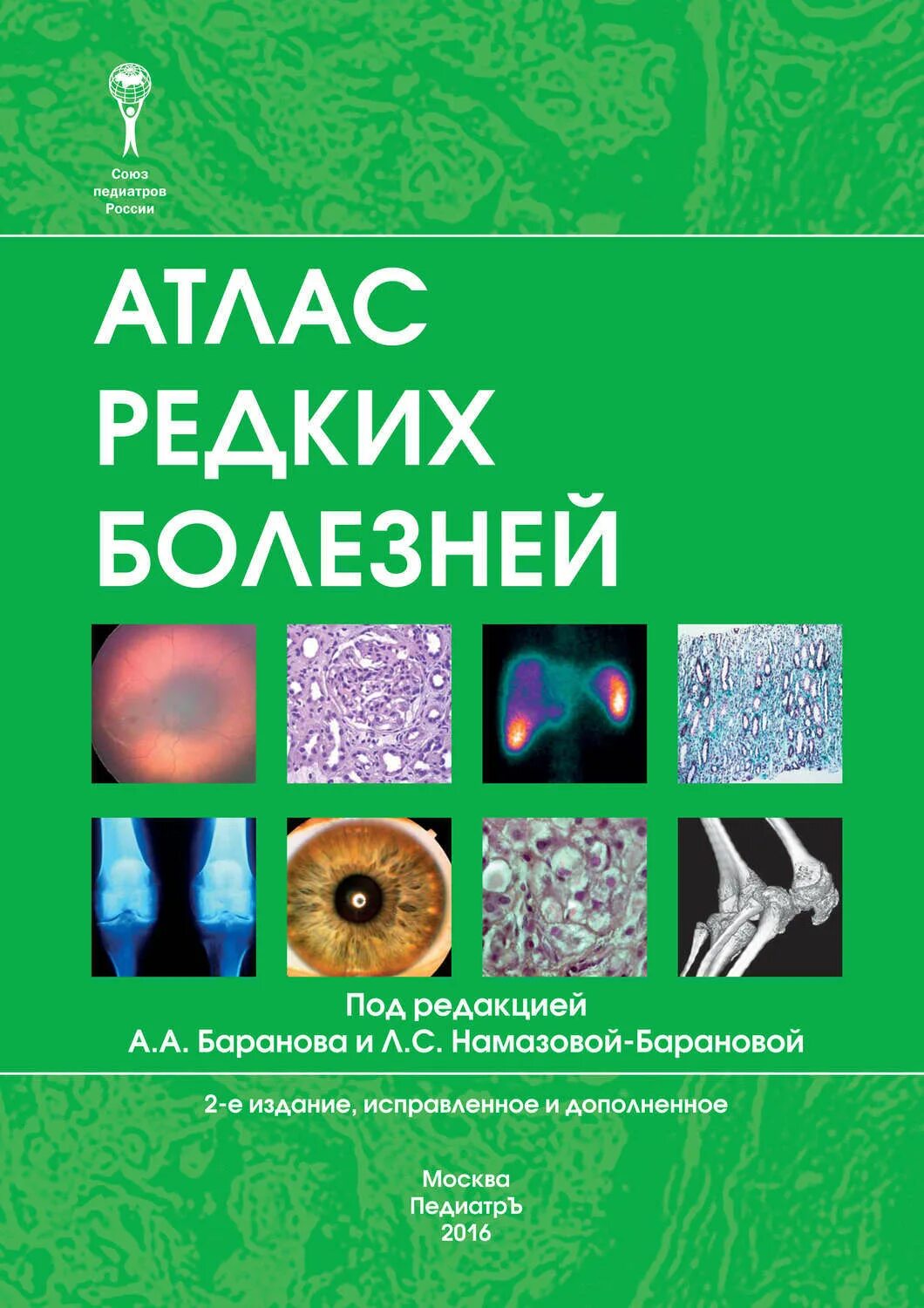 Редкие заболевания список. Редкие заболевания названия. День редких орфанных заболеваний. Пауль карасон. Редкие заболевания названия.