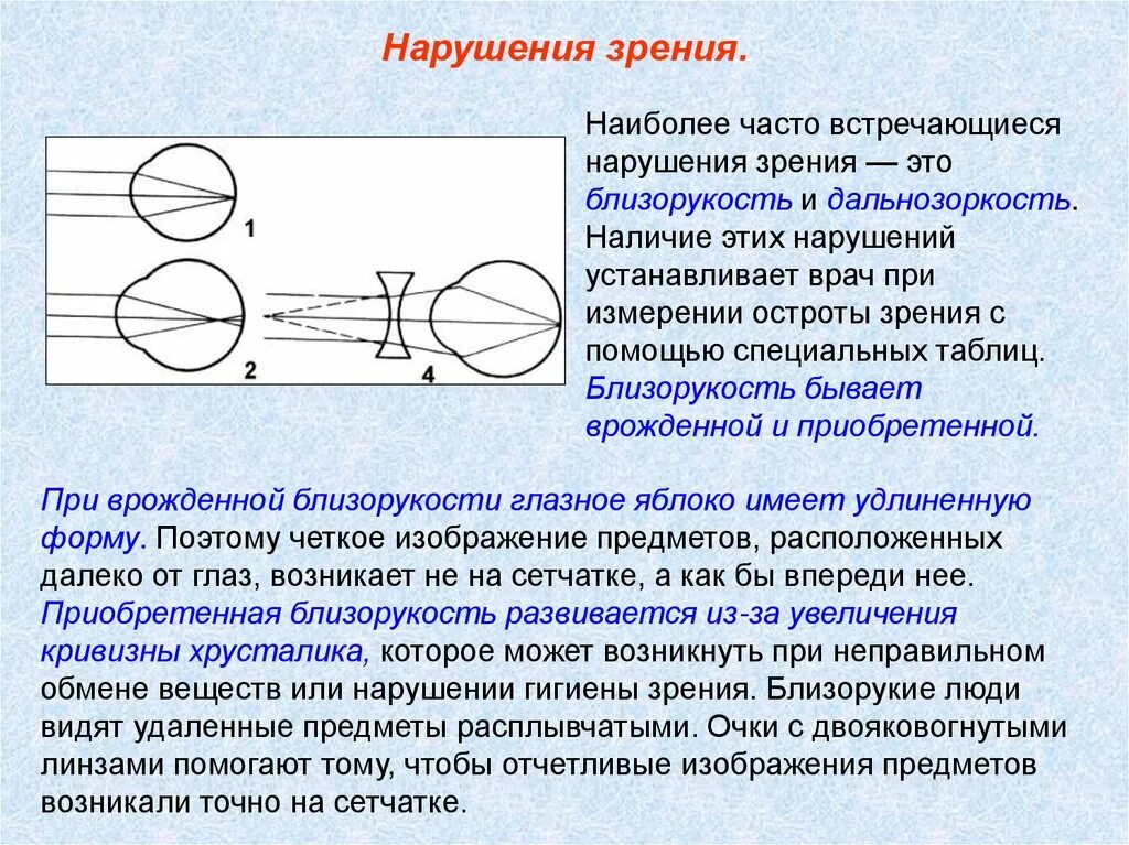 Нарушения функций зрения. Зрительный анализатор дальнозоркость и близорукость. Строение анализатора зрения. Зрительный анализатор строение и функции глаза. Близорукость и дальнозоркость ЕГЭ.