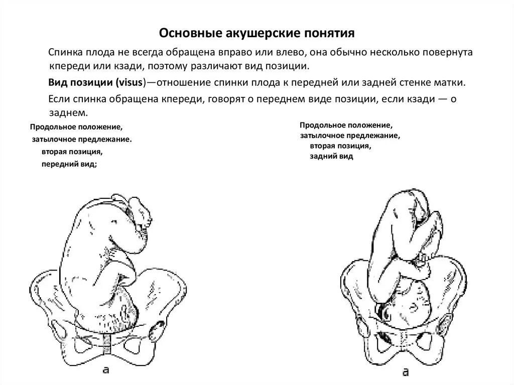 Что означает предлежание. Основные акушерские понятия положение плода. Головное предлежание плода 1 позиция передний вид. Первая позиция передний вид затылочного предлежания. 1 Позиция плода при беременности.