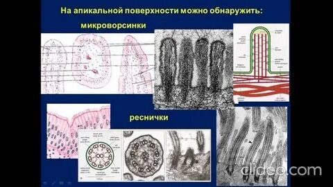 Эпителий с микроворсинками называется