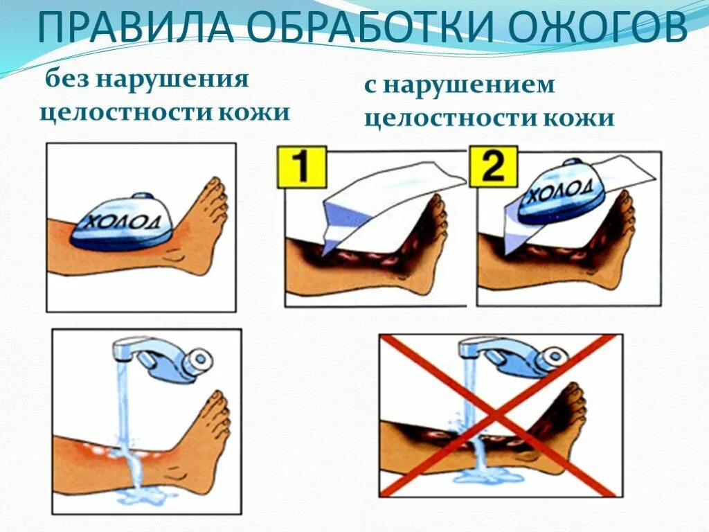 Обработка термических ожогов. Обработка ожога с нарушением целостности. Обработать ожог с нарушением целостности.