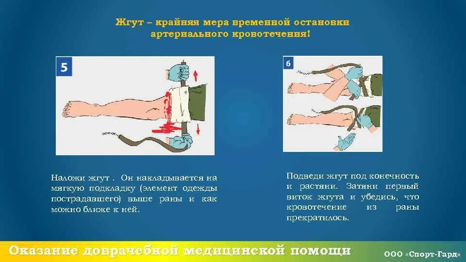 При наложении кровоостанавливающего жгута. Наложение жгута при кровотечениях в летнее и зимнее. Артериальное кровотечение жгут. Наложение жгута для остановки кровотечения. Правила наложения жгута.