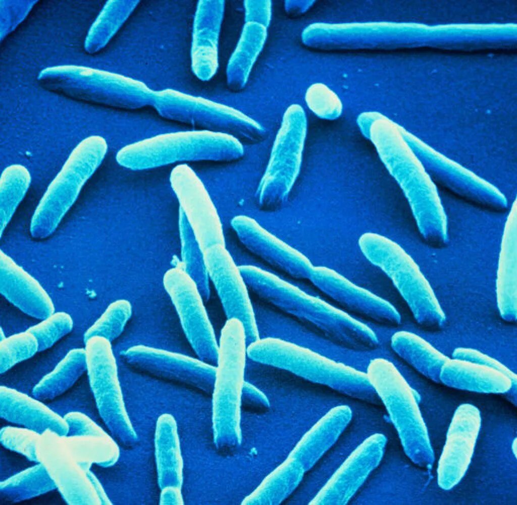 Псевдомонада aeruginosa. Бактерия Pseudomonas aeruginosa. Pseudomonas aeruginosa микробиология. Псевдомонады синегнойная палочка микробиология. Бактерия синегнойная палочка