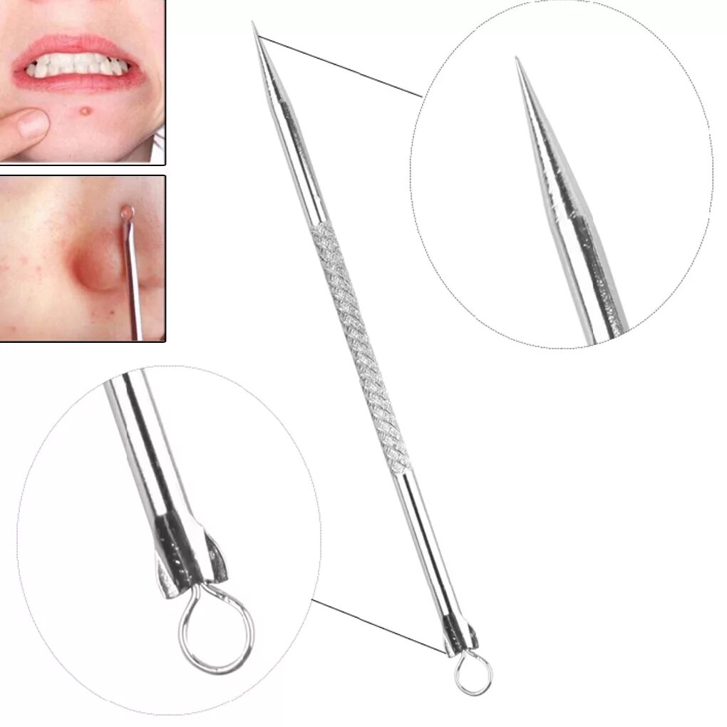 Экстрактор для очищения пор Tweezerman Blackhead Extractor. Петля Видаля для чистки лица. Выдавливатель угрей черных