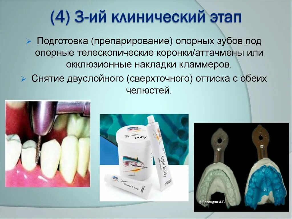 Клинико-лабораторные этапы изготовления бюгельного протеза. Лабораторные этапы изготовления бюгельного протеза. Бюгельный протез клинические этапы. Клинико лабораторные этапы изготовления бюгельных протезов. Бюгельные протезы лабораторные этапы