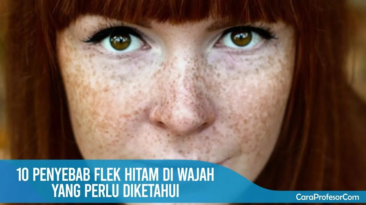 веснушки на английском. коричневые веснушки. девушка с веснушками. девушка с веснушками. веснушки на лице.