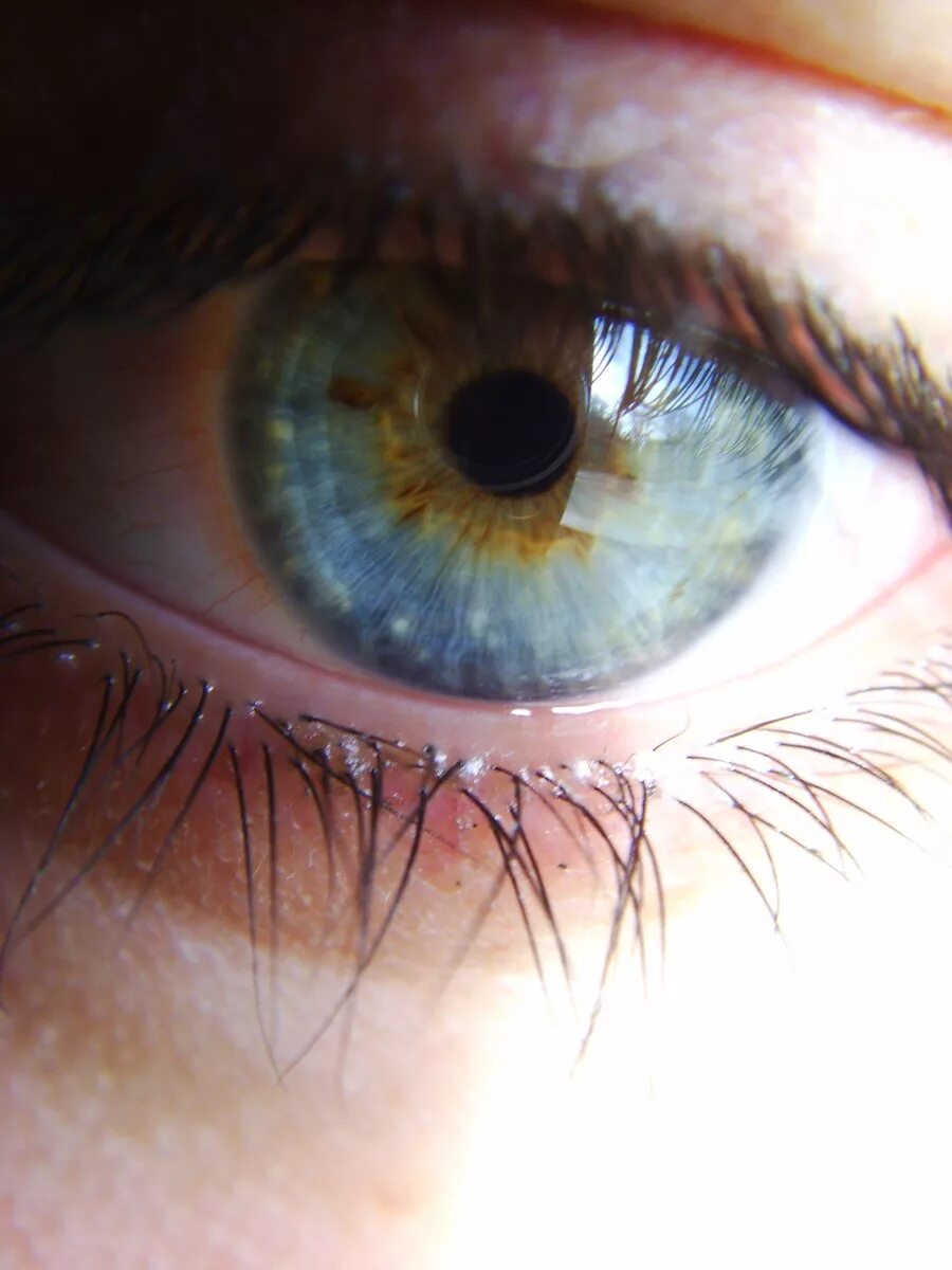 Пелена на глазах какие. Болотный цвет глаз гетерохромия. Центральная гетерохромия карих глаз. Центральная гетерохромия Хейзел. Гетерохромия Радужки глаз.