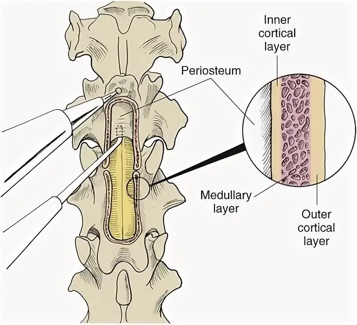 Layers bone