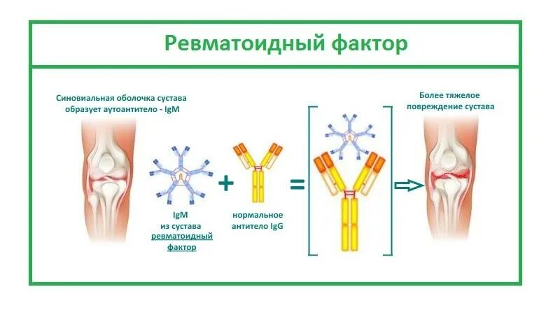 Повышение ревматоидного фактора. Предрасполагающие факторы ревматоидного артрита. Анализ ревматоидный фактор 0.6. Ревматоидный фактор у здорового человека. Ревматоидный фактор механизм образования.