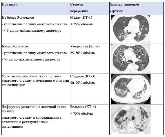 Поражение легких при кт коронавирус. Степени поражения легких при коронавирусе по кт. Степени ковид на кт. Степени пневмонии на кт. Ковид симптомы по дням 2024