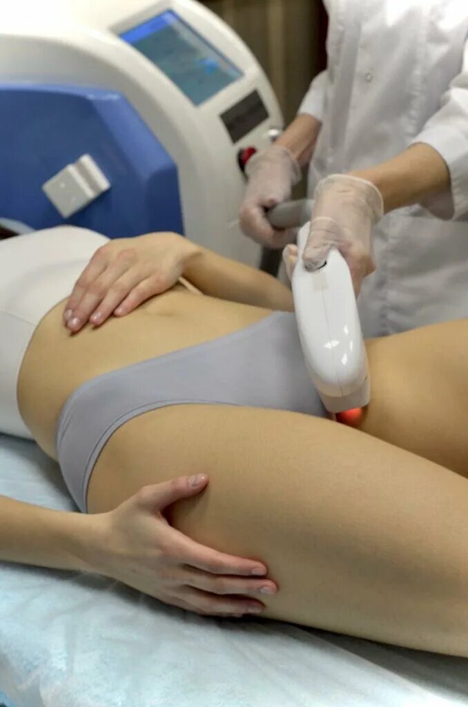 Fotona эпиляция. фотосессия для салона лазерной эпиляции. эпиляция москва отзывы. лазерная эпиляция екб. фотоэпиляция.