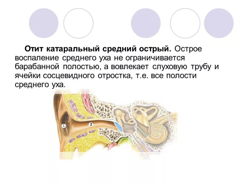 Средний отит у взрослых. Острый катаральный средний отит у детей. острый катаральный средний наружный отит. острый катаральный отит среднего уха. острый катаральный средний отит клиника.