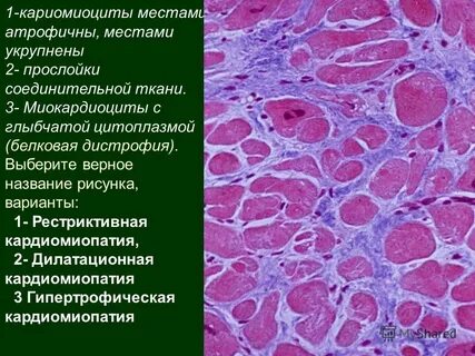 Прослойки соединительной ткани