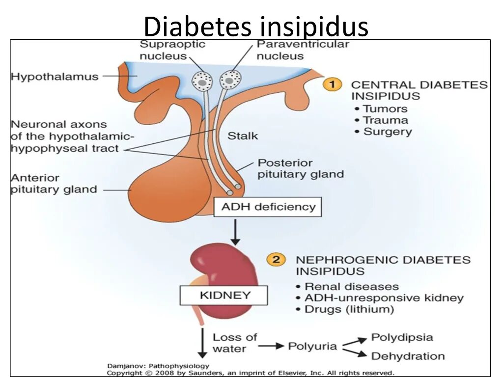 Несахарный диабет гипоталамус. Central Diabetes insipidus. Nephrogenic Diabetes insipidus. Несахарный диабет развивается в результате