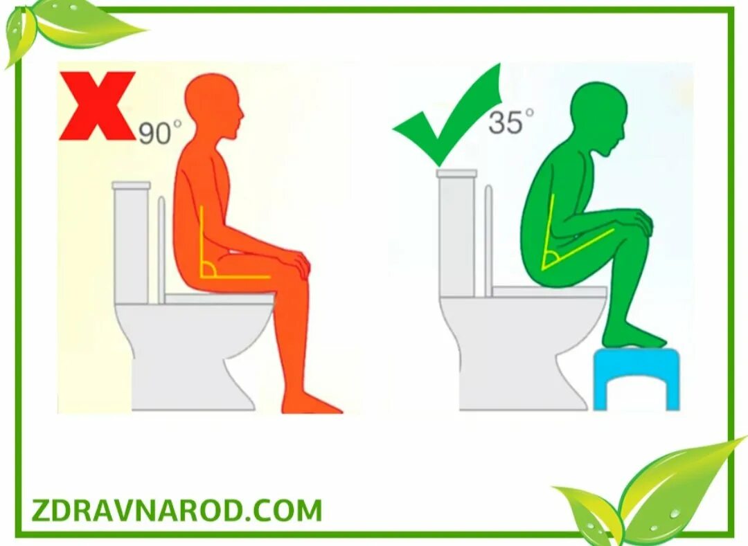 Правильная поза для туалета. Правильная поза для туалета по большому. Правильная поза для дефекации. Правильная поза на унитазе при запоре.