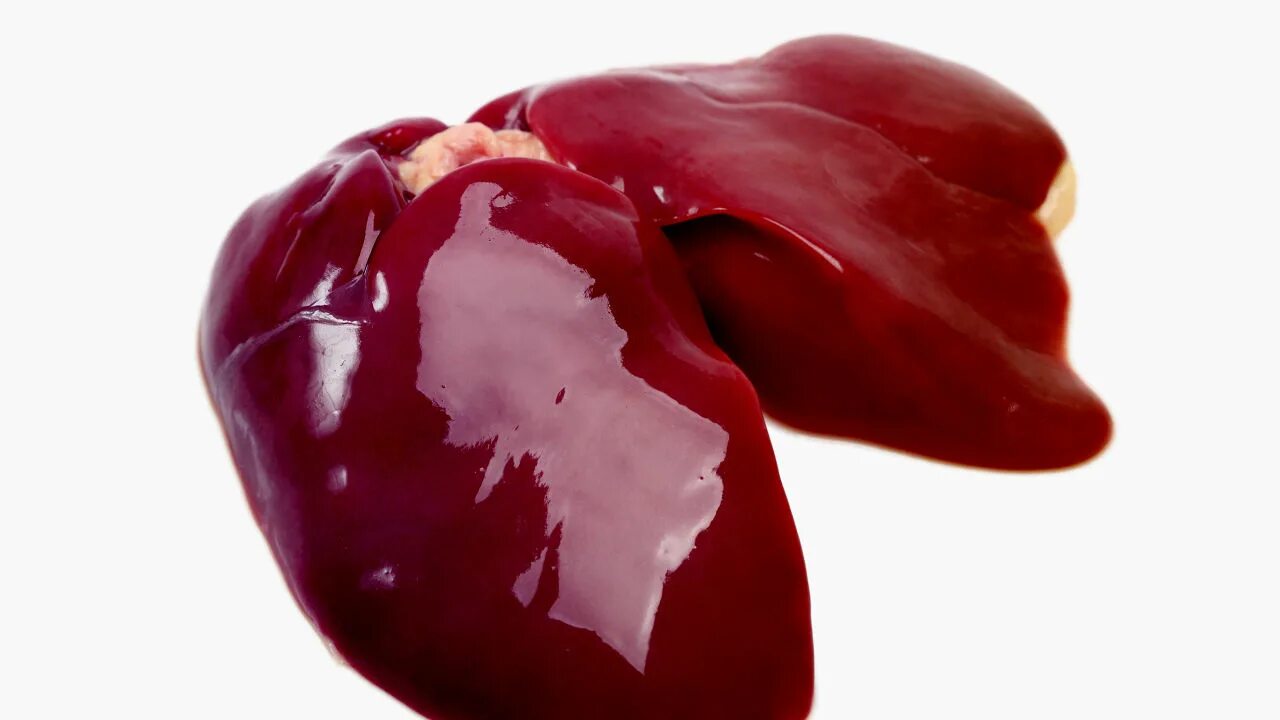 Говяжья печень с оранжевым оттенком. Красная печень. Что такое гепатомегалия жирового гепатоза. Нормальная печень и цирроз. Признаки заболевания печени.