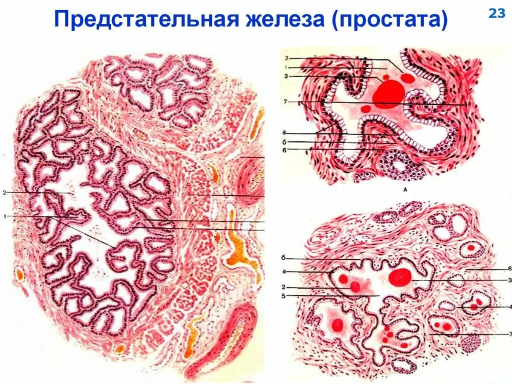 Предстательная железа гистология препарат. Строение предстательной железы гистология. Срез предстательной железы гистология. Простатическая железа гистология. Ткань простаты