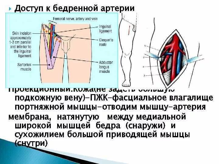 Бедренная перевязка. Паховая Вена у мужчин анатомия. Паховая Вена катетеризация. Проекционная линия подвздошной артерии. Проекция перевязки бедренной артерии.