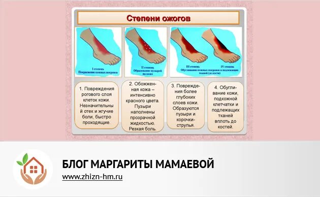 Как долго заживают ожоги 2 степени. Как долго заживают ожоги 2 степени