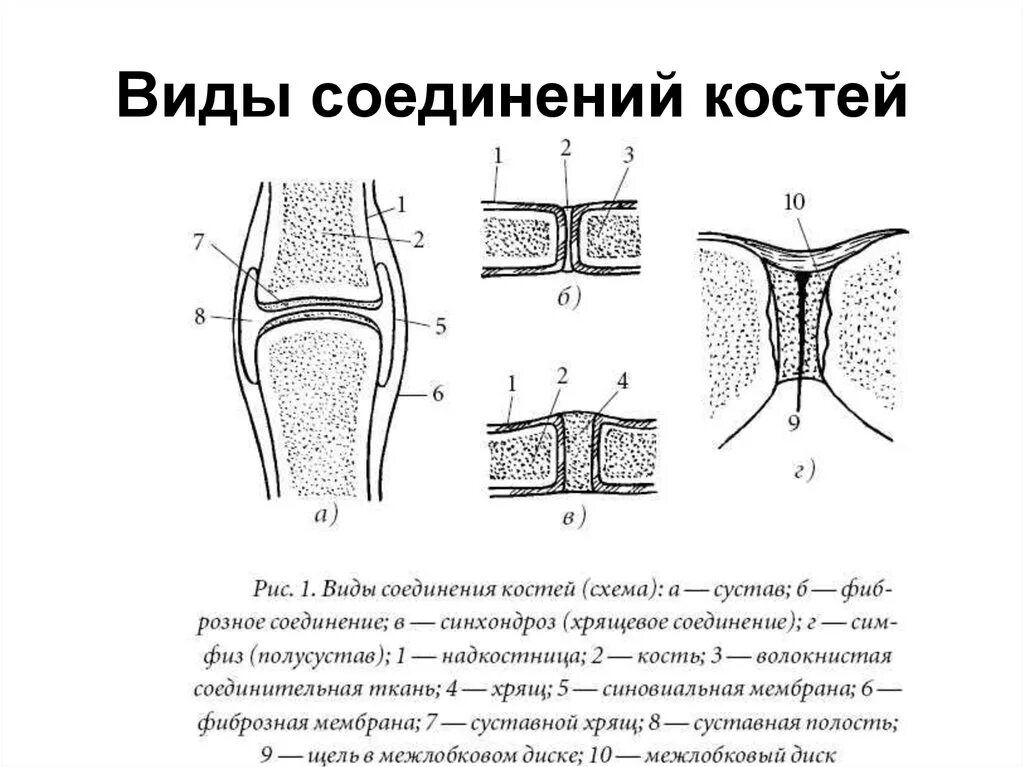 Соединение костей шов кости. Типы соединения костей схема. Непрерывные соединения костей анатомия. Схема непрерывных соединений костей. Непрерывный Тип соединения костей.