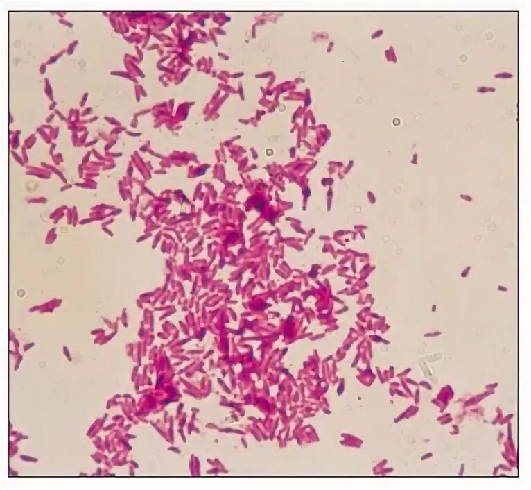 Mobiluncus spp corynebacterium в мазке