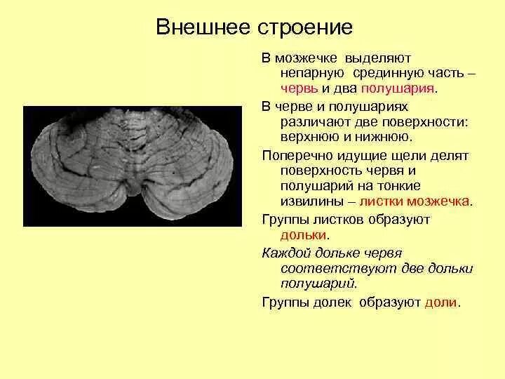 Мозжечок два полушария. Мозжечок анатомия внешнее строение. внешнее строение мозжечка. анатомическое строение мозжечка. червь мозжечка анатомия.