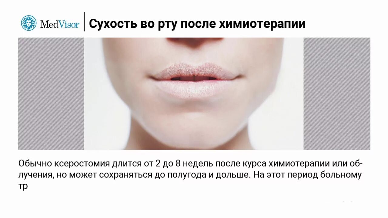 Почему во рту сухость причины утром. Слюноотделение сухость во рту. Во рту сухость и вязкость причины. Народные средства при сухости во рту.